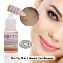 10 мл, средство для удаления кожных ярлыков, кожный ярлык, средство для удаления бородавок, средство для удаления кукурузы, средство для ухода за кожей