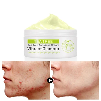 

VIBRANT GLAMOUR Tea Tree Anti-acne Face cream Acne Scar Cream Shrink Pores Facial Eliminates Acnes Cream Oil control Repair Spot