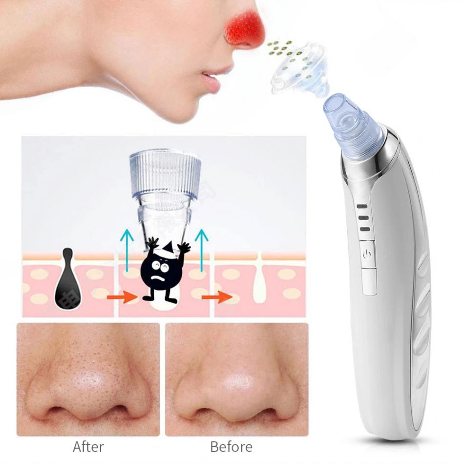 

Vacuum Blackhead Acne Remover Facial Suction Pore Cleaner Comedo Spot Cleanser Face Skin Care Beauty Device Blackhead Cleaner 5