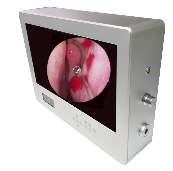 Aliexpress.com : Buy ENT 1920*1080P FULL HD MEDICAL ENDOSCOPE CAMERA