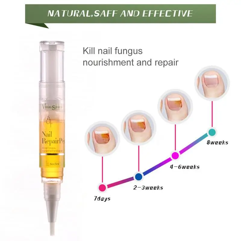 1 шт. ручка для лечения грибков для ногтей против грибковой инфекции биологический Восстанавливающий раствор питательное масло 3 мл восстанавливает здоровые ногти на ногах