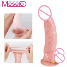 Meselo Full Penis Cover Men Sex Toy Reusable Condoms Delay Ejaculation Enlarge Cock Sleeve Ring Erotic Adult Product For Male
