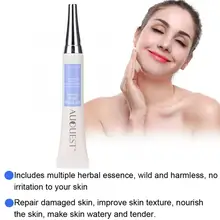 20 г маска от акне удаление крем анти Комедо ремонт гель средства по уходу за лицом