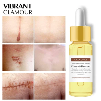

VIBRANT GLAMOUR Repair Scar Face Serum Crocodile Whitening Moisturizing Skin Treatment Removal Acne Scar Stretch Marks Skin Care