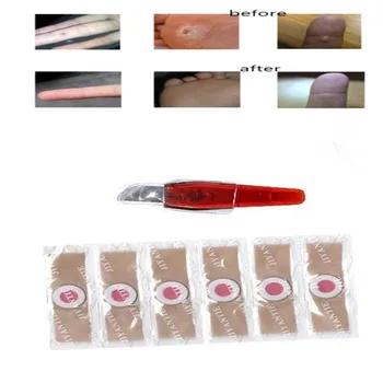 

10pcs Chicken Eye Patch Corn Removal Plasters 1pcs Pedicure Knife Reduce Care Relieve Pressure Patch Foot Care Relief Pain Paste