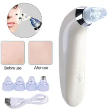 ETEREAUTY уход за кожей пор вакуумное средство для удаления угрей акне Удаление прыщей вакуумный всасывающий инструмент для очищения лица удаление акне