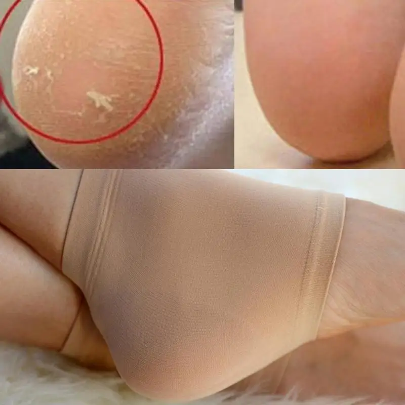 

2pcs/1Pair Gel Heel Socks Like Cracked Foot Skin Care Protector Silicone Moisturizing Health Feet Protect Size L Foot Care Tool