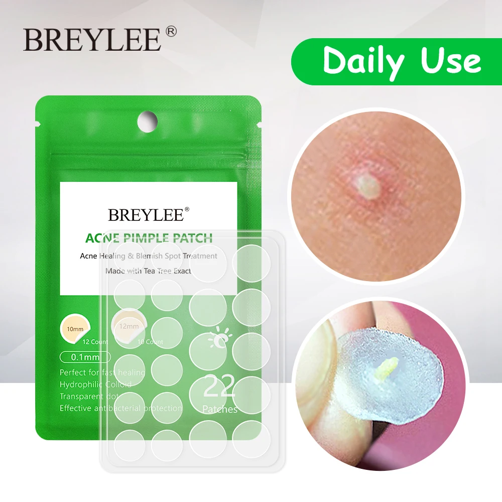 

BREYLEE Acne Pimple Patch Acne Treatment Stickers Pimple Remover Tool Blemish Spot Skin Care Facial Mask Waterproof Daily Use