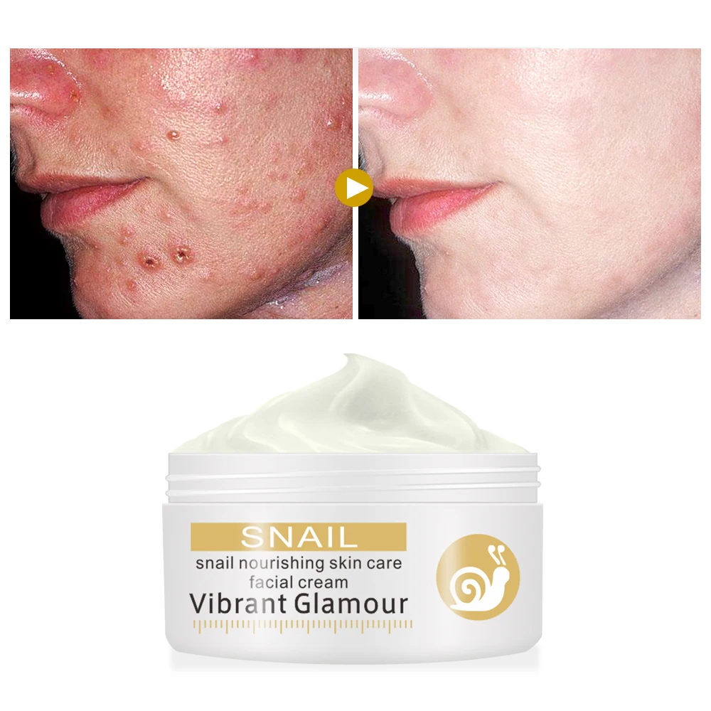 

VIBRANT GLAMOUR Repair Snail Face Cream Remove Wrinkles Acnes Cream Whitening Brighten Skin Wrinkle Control Oil Skin Repair Care