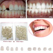 2 упаковки стоматологических материалов смешанные временные короны задние виниры зубы стоматолога продукты Отбеливание зубов поддельные зубы поставки