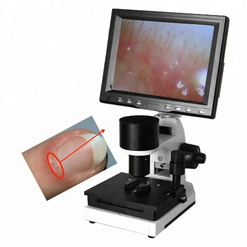 

2019 Color nailfold Microscopy/nailfold mikroskop/capillary microscope