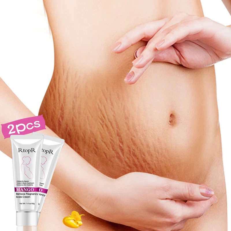 

Women Stretch Mark Repairing Cream Pregnancy Mark Remove Skin Care Cream