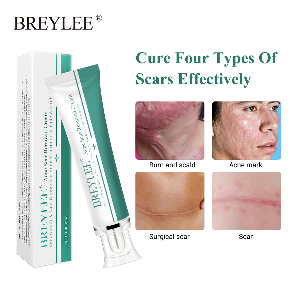Breylee 3pcs Acne Scar Removal Cream Face Cream Skin Repair Skin Care Scar Acne Treatment Remove Stretch Marks Whitening Cream