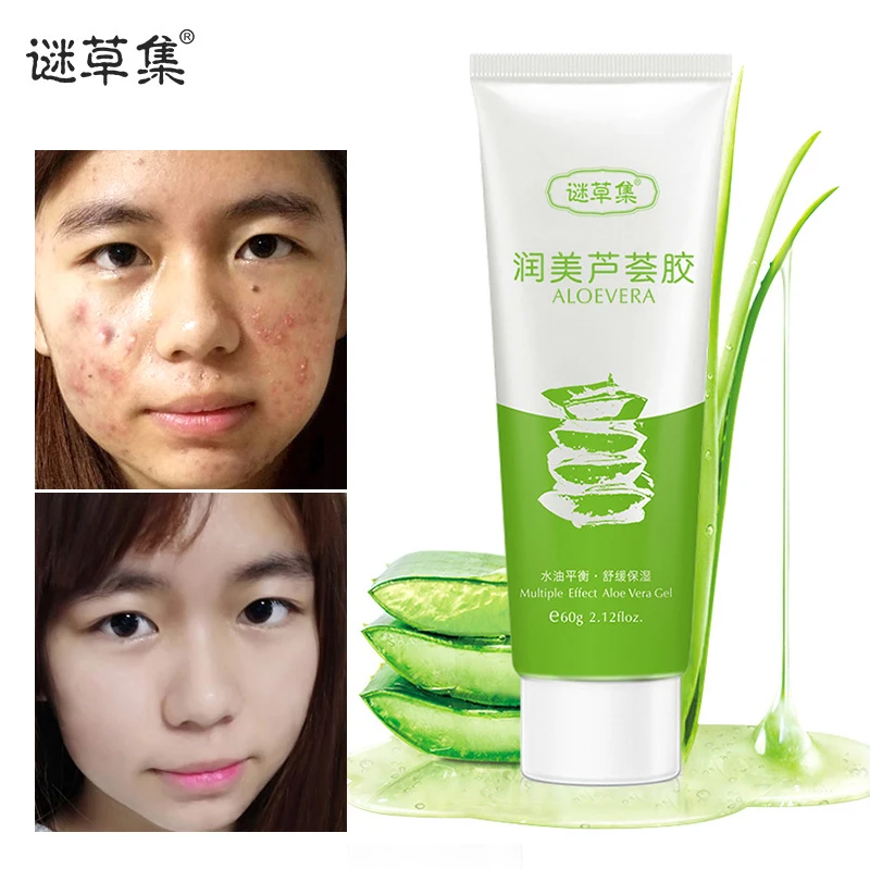 

MICAOJI Aloe Vera Smooth Gel Acne Treatment Face Cream Hydrating Repair After Sun Soothing Whitening Balanced water oil Mask 60g