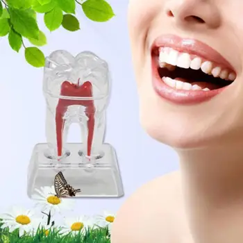 

Dental Dentistry Crystal Base Hard Plastic Teeth Tooth Molar Model Health Care Tool Children Kids Teeth Health Education Model