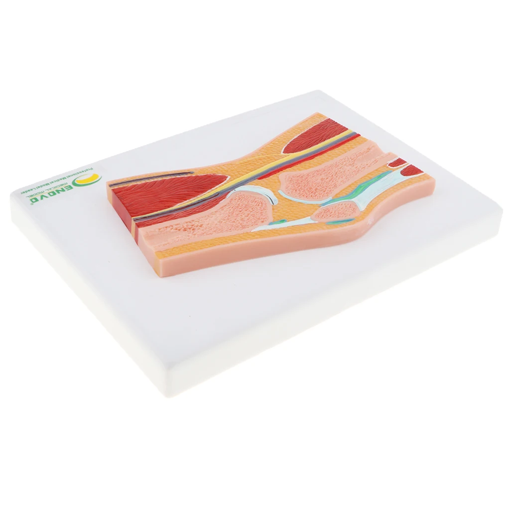 

Lifesize 1:1 Advanced Human Knee Joint Muscle Skeleton MRI Section Medical/Anatomical Model Display Lab Supplies