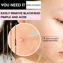 LANBENA розовое золото акне иглы угрей и прыщей и Комедон удаления экстрактор от кожи ance лечение Комедон 4 шт./набор