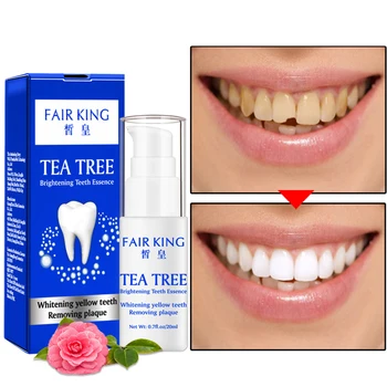 

Professional High Quality Brightening Teeth Whitening Essence Deep Cleansing Teeth Remove Stains Yellow Teeth Oral Nursing Tool