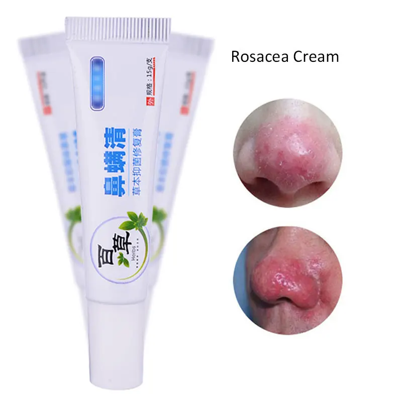 Anti Nose Mites Remove Acne Rosacea Cream Red Nose Blackhead Treatment