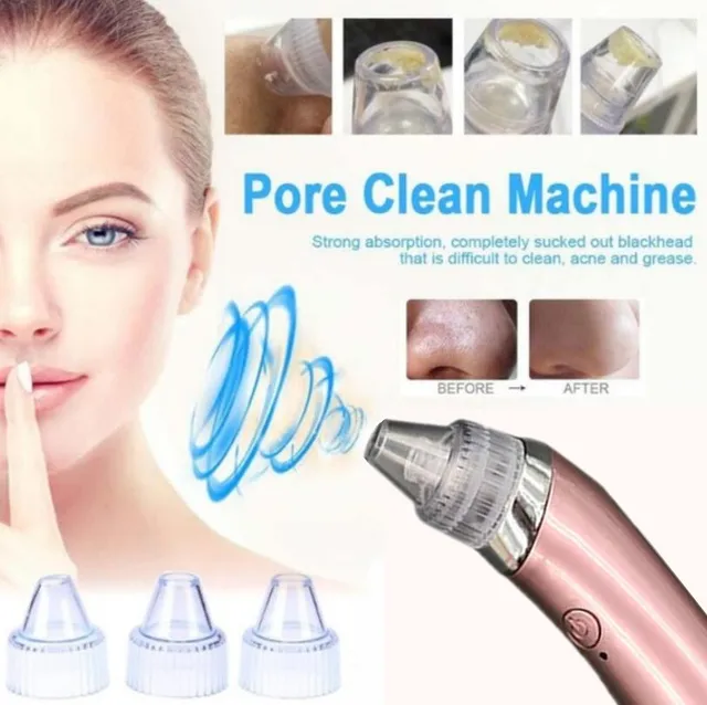 Blackhead Vacuum Electric Pore Cleaner Acne Blackhead Remover Pore