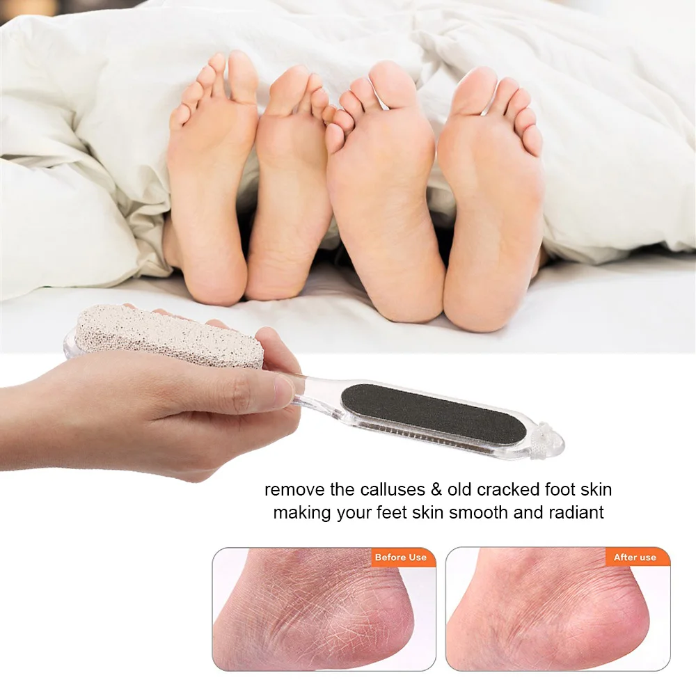 

4-In-1 Pedicure Tool for Foot Care Callus Remover Foot File Rasp Professional Dead Hard Skin Removal Grinding Foot Heel File