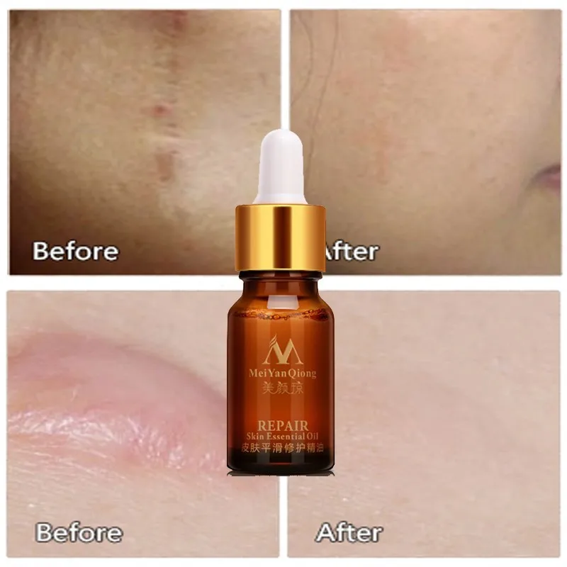 Lavender Fragrance Essential Oils Pure Natural Skin Repair Essential