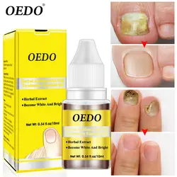 Oedo травяные Антибактериальные Средства для ухода за ногтями эфирные масла Инструменты для ремонта ногтей