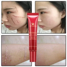 Крем для удаления шрамов и акне, восстанавливающий кожу, крем для лица, лечение прыщей, лечение угрей, отбеливающий крем против шрамов, растяжек, 15 мл