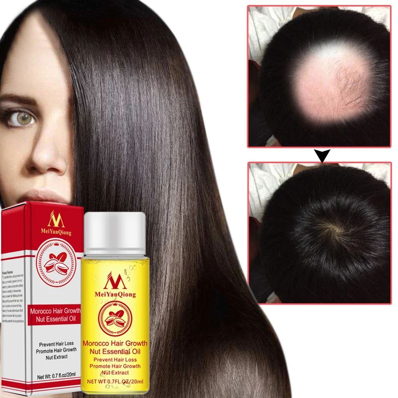 Hair Moisturizing Moroccan Argan Oil Pure Macadamia Nut Hair Care Oil 20ml Hair Moisturizing Moroccan Argan Oil Pure Macadamia Nut Hair Care Oil 20ml