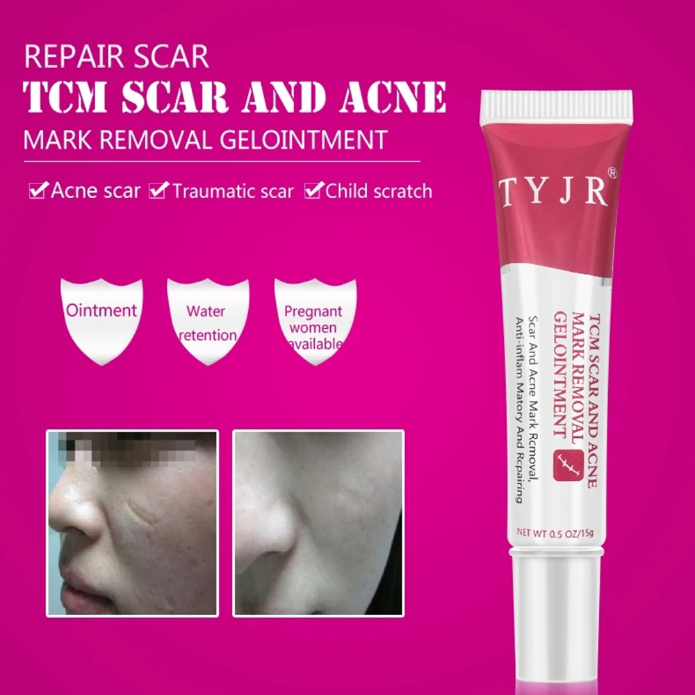 Scar Repair Remove Cream Scar Remover Gel Moisturizing Scars Acnes