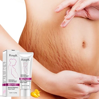 

2019 new remove pregnancy scars cream maternity repair stretch marks treatment body creams anti-aging anti winkles firming cream