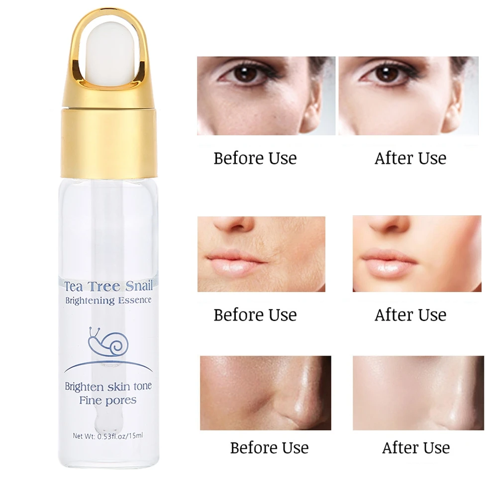 

15ml Snail Slime Face Anti-aging improved tone and clarity Whitening Anti Wrinkles Cream