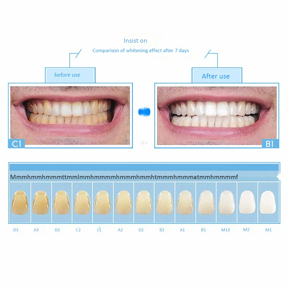 2 5 мл портативный отбеливатель зубов Pen Gel Teeth Whitener Kit Instant Natural Whitener|Отбеливание