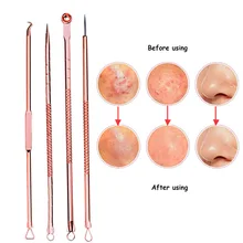 Efero 4 шт. двухсторонняя нержавеющая сталь угорь, прыщ, акне игла розовое золото удаление акне Remover средства по уходу за кожей