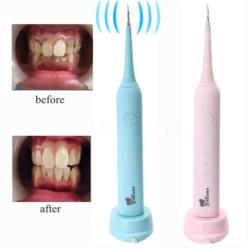 

Dental Ultrasonic Dental Scaler Handpiece Electric USB Cleaning Tooth Whitening Teeth Odontologia Tools Oral Health