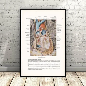 

Aorta Esophagus Pericardium Medical Illustration Art Canvas Poster Wall Pictures for Living Room No Frame