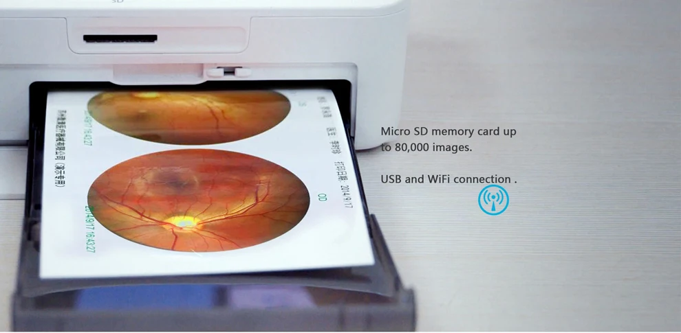  Portable Handheld Fundus Camera With FDA For USA
