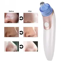 Вакуумный отсос угрей удаление перезаряжаемые лицо поры очиститель машинка для пилинга кожи s