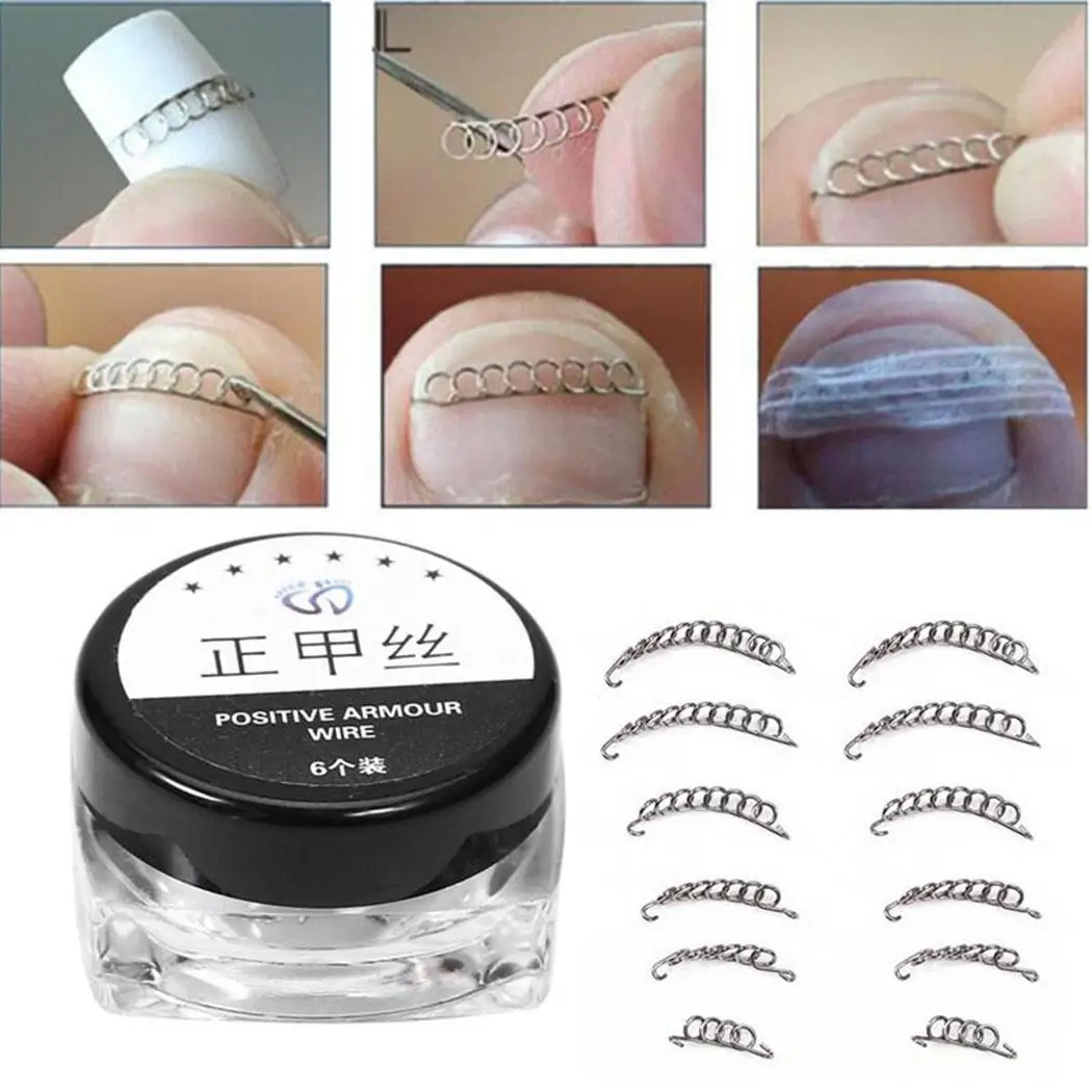 

Tool Wire Ingrown Correction Unisex Toe Toenail Pedicure Care Nail Silver Foot Tools Recover Fixer