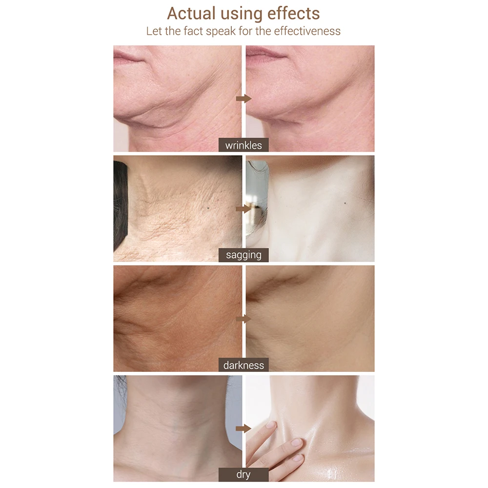 

OEDO LANBENA Hydrating Neck Cream Neck Mask Anti Wrinkle Firming Reduce Fine Lines Relieving Health And Beauty Skin Care