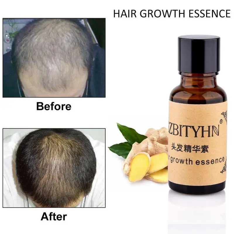 20ml Hair Care Growth Essential Oil Essence Original Loss Liquid Health Dense Anti-Alopecia Nourishing Moisturizing | Красота и
