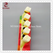 Учебная модель для стоматологов показывает стадию пародонтальных заболеваний/модель обучения зуб/Стоматологическое использование пародонтальной модели