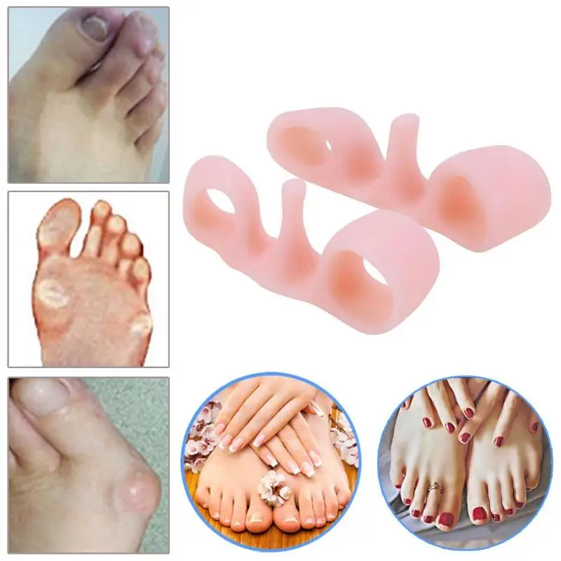 

1pair Toe Separator Finger Hallux Valgus-toed Foot Bones Authentic Overlapping Toe Correction Orthoses Corrective Insoles
