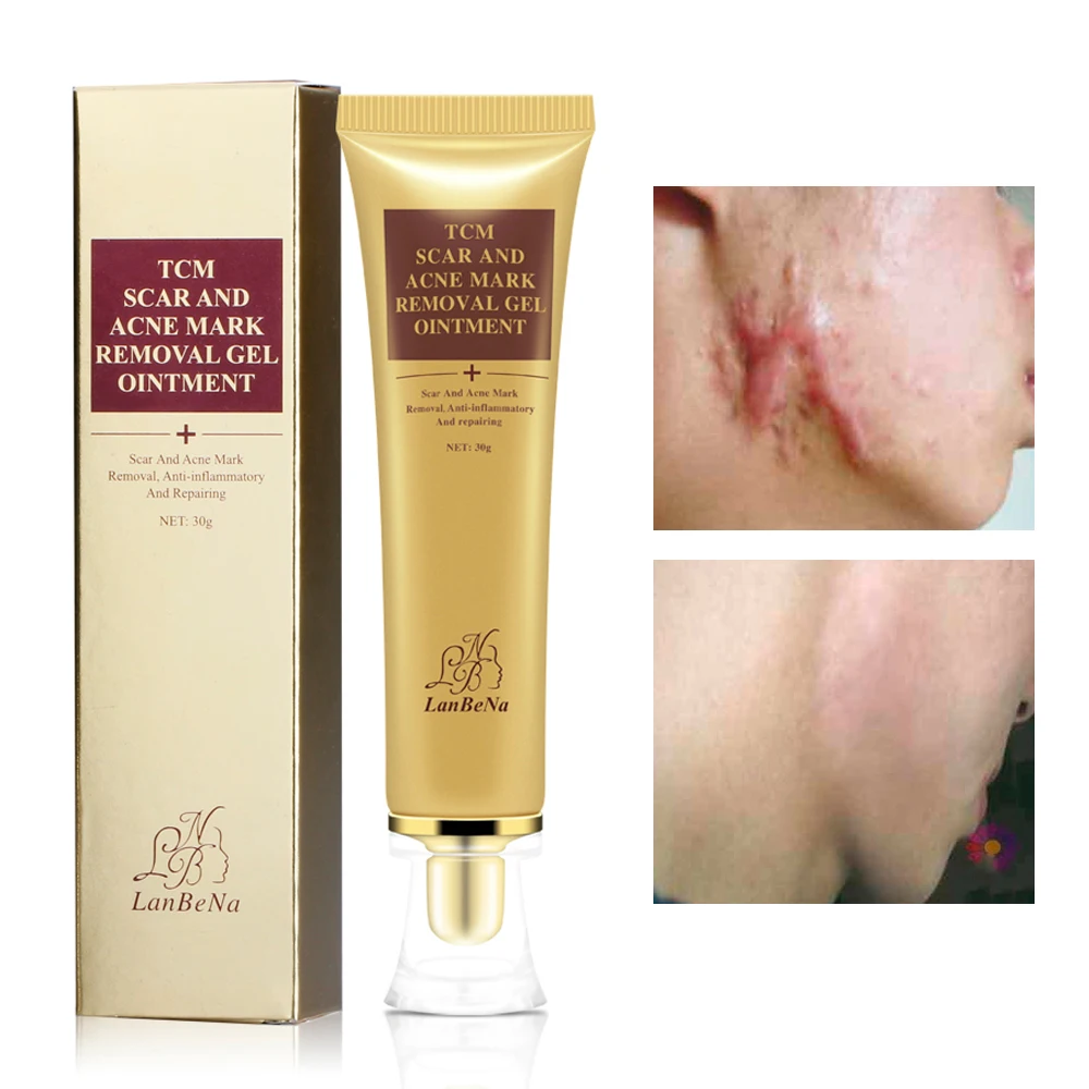 

LANBENA Acne Scar Removal Cream Against Black Dots Scar Removal Skin Care Scar Removal Cream Facial Blackhead Acne Treatment
