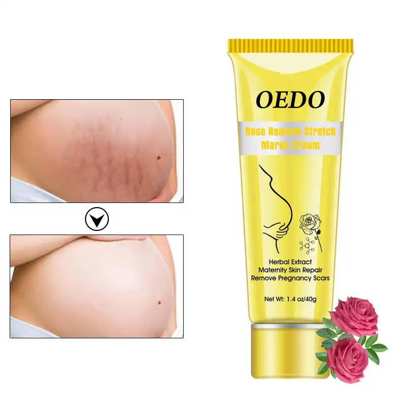oedo stretch mark cream price