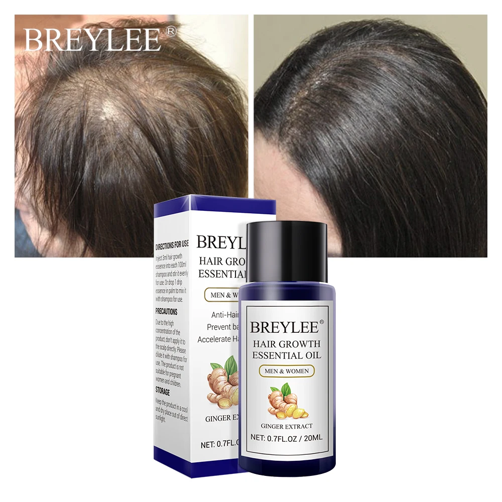 BREYLEE эфирное масло для быстрого роста волос мощные Продукты для волос питательная сыворотка для предотвращения облысения против выпадения волос уход за волосами 20 мл