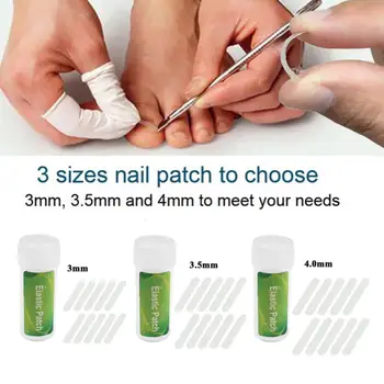 

30pcs patch set Professional Ingrown Toe Nail Correction Pedicure Tools Foot Care Fix Clip Toenail Protector Treatment Kit 3 Sty