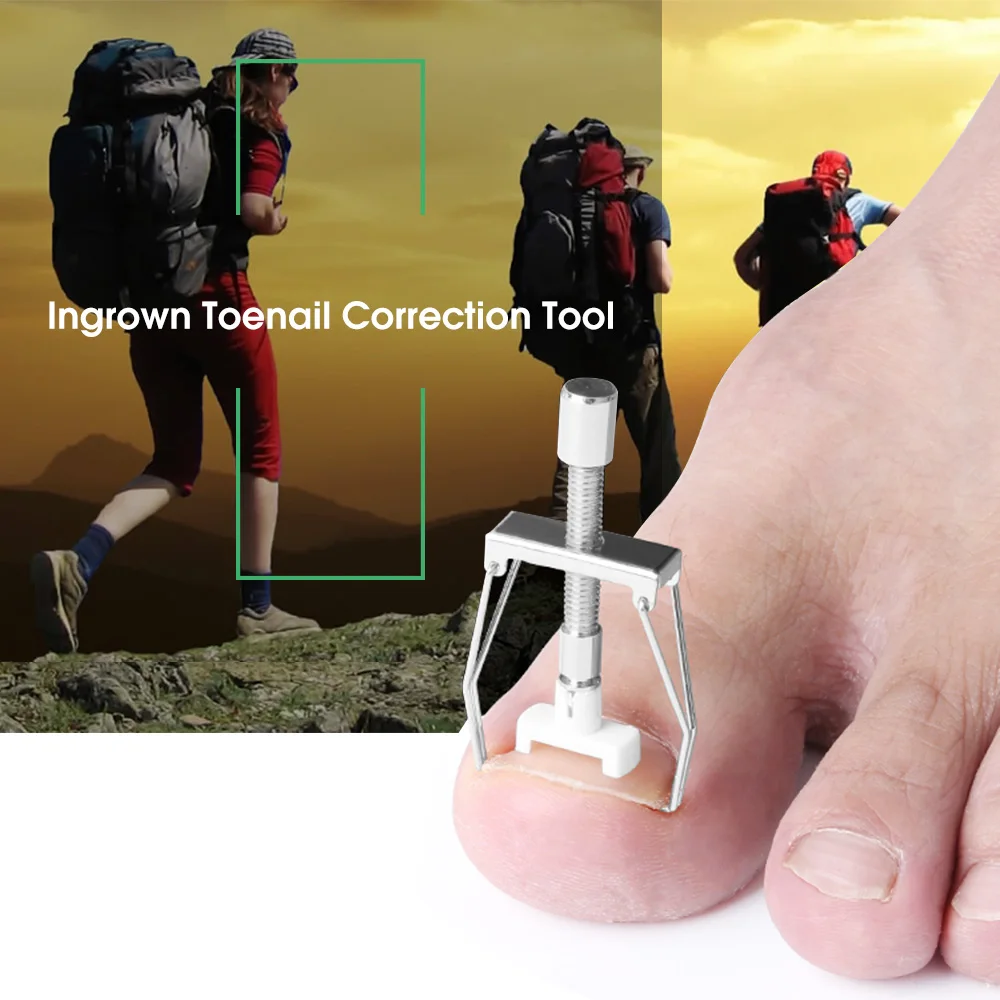 

Ingrown Toenail Correction Tool Nail Corrector Tool Kit Toe Paronychia Nail Brace Pedicure Care Tool