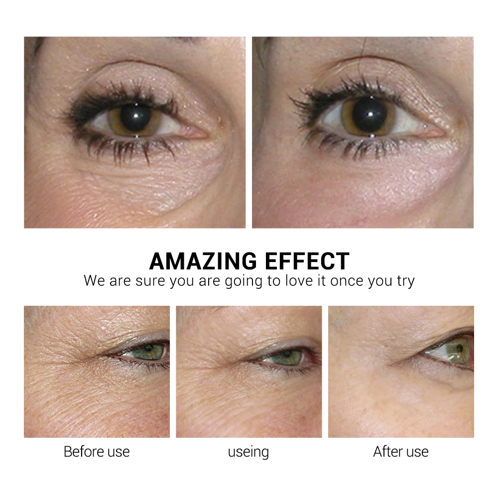 

NEW LANBENA Retinol Eye Mask Hyaluronic Acid Eye Patches Serum Reduces Dark Circles Bags Eye Lines Repair Firming Skin Care
