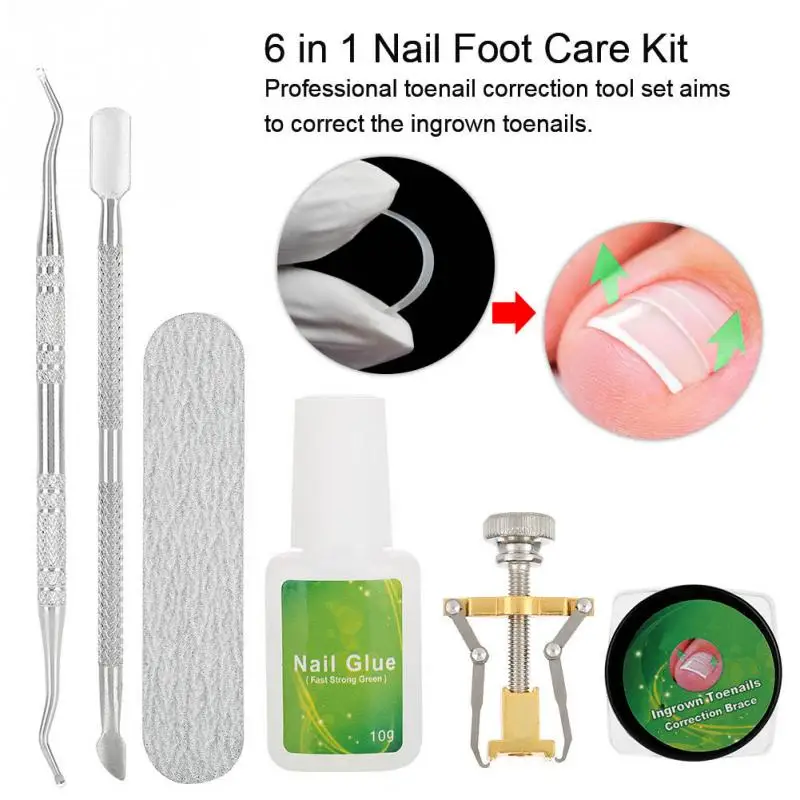 

6 in 1 Set Foot Care Ingrown Toe Nail Fixer Pedicure Toenail Recover Correction Tool Nail Foot Care Kit Accessories